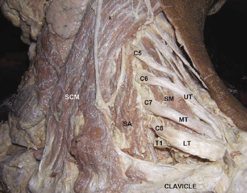 Plexus brachial 5